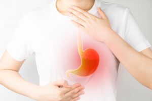 What is Heartburn ?-colon digestive image