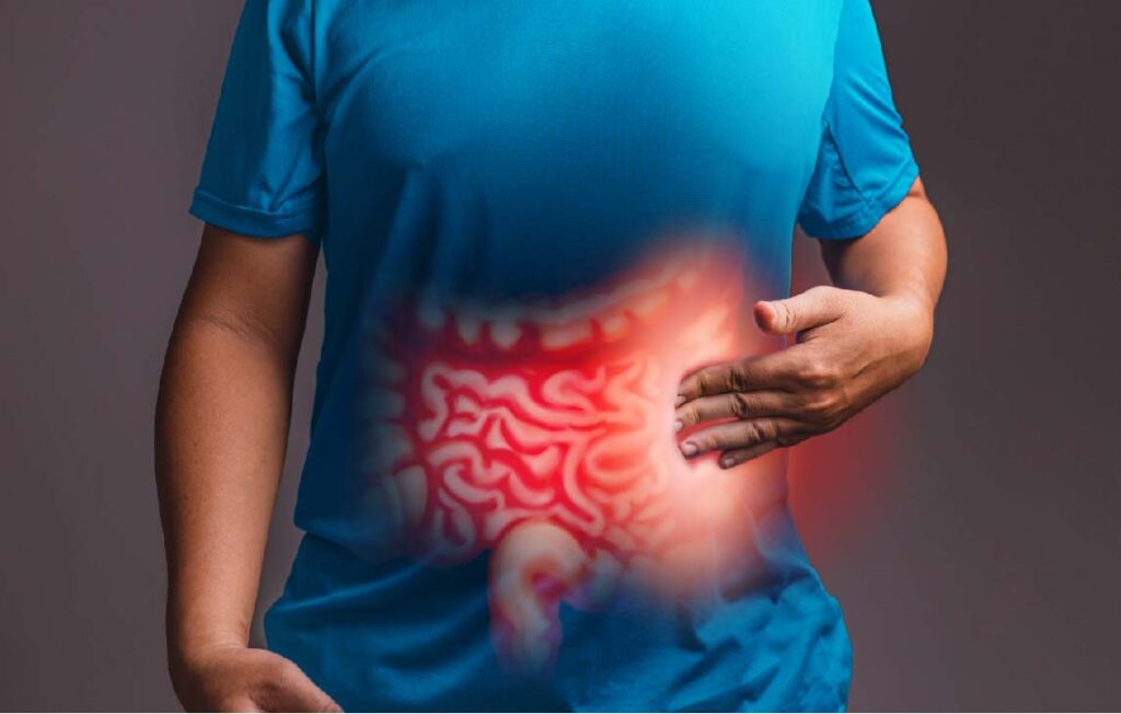 What is Colon Cancer - colon health specialist