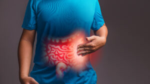 Irritable Bowel Syndrome - colon digestive health specialists.